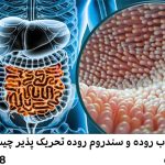 تفاوت التهاب روده (IBD) با سندرم روده تحریک‌پذیر (IBS)