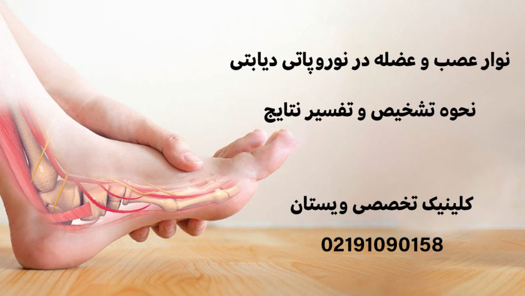نوار عصب و عضله در نوروپاتی دیابتی + نحوه تشخیص و تفسیر نتایج