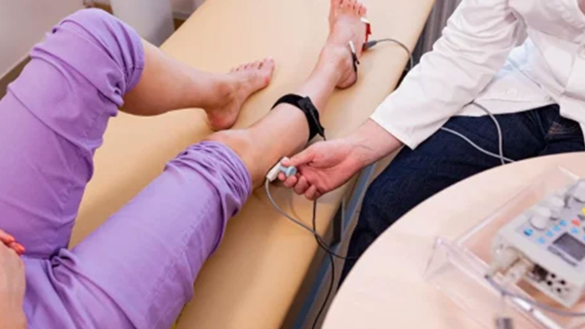 نوار عصب و عضله برای دیابت (EMG/NCV)؛ دکتر در حال انجام تست نوار عصب و عضله دکتر در حال انجام تست نوار عصب و عضله نوروپاتی دیابتی روی پای بیمار
