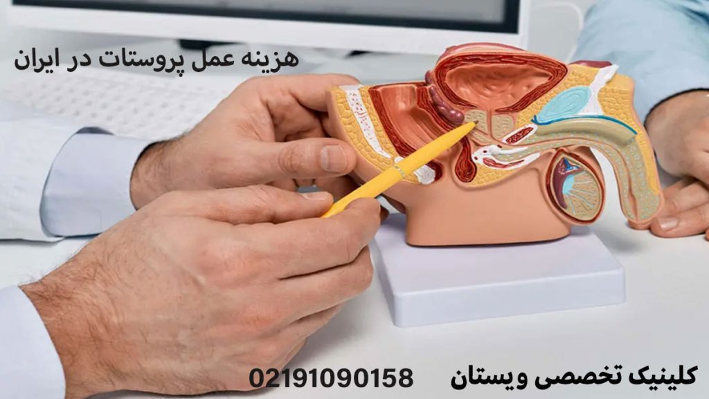 هزینه عمل پروستات + هزینه TURP و جراحی رباتیک پروستات 1405