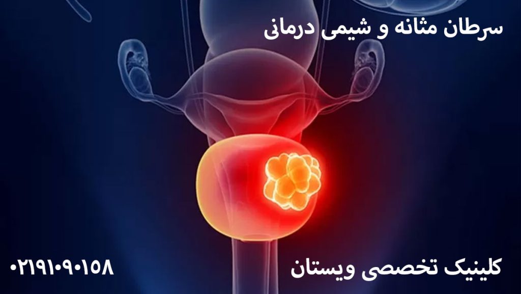 هزینه سرطان مثانه با بیمه تامین اجتماعی + هزینه شیمی درمانی 1405