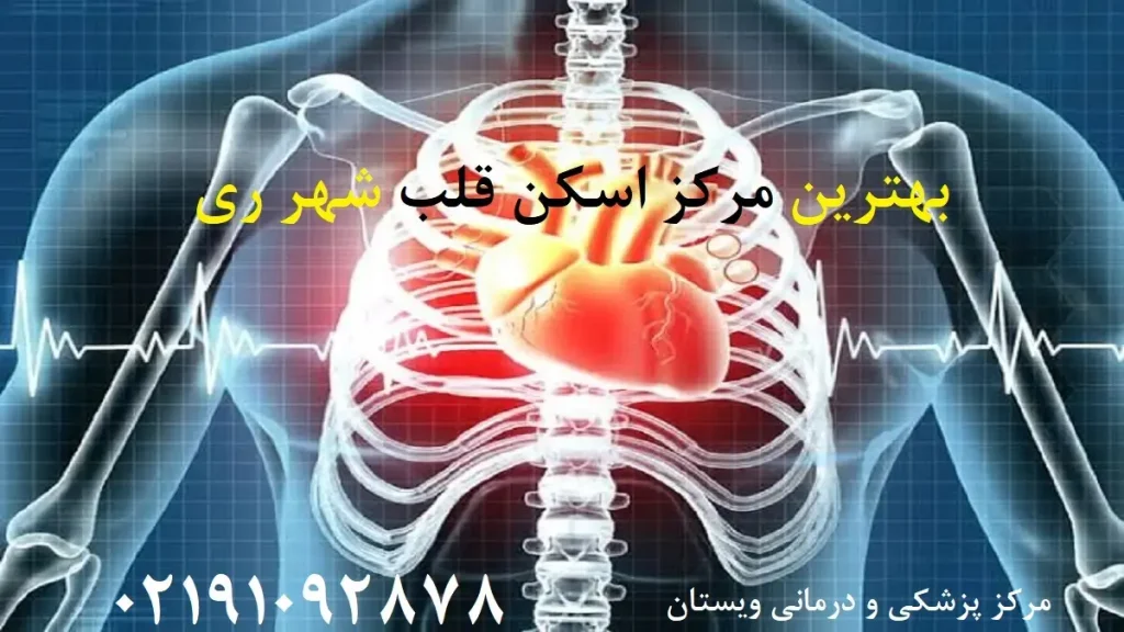 معرفی بهترین مرکز اسکن قلب شهر ری | نوبت دهی و هزینه ۱۴۰۵